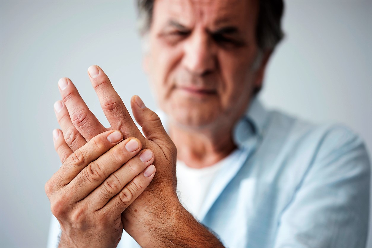 CBD FOR ARTHRITIS: WHAT YOU NEED TO KNOW
